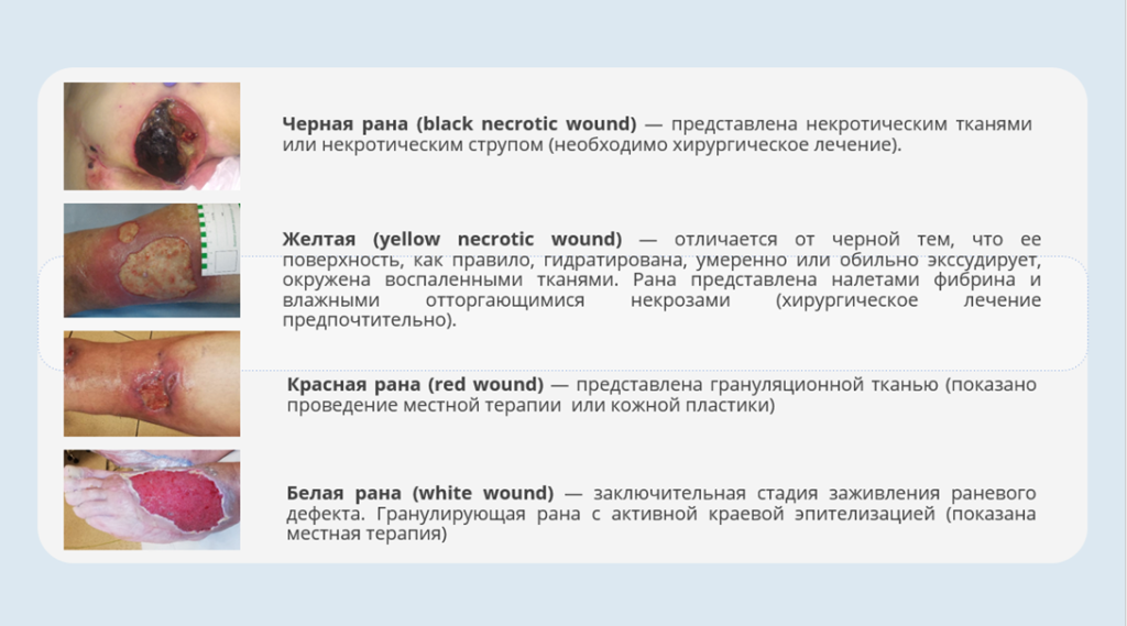 Уход за ранами: как ускорить заживление и когда следует вызвать врача